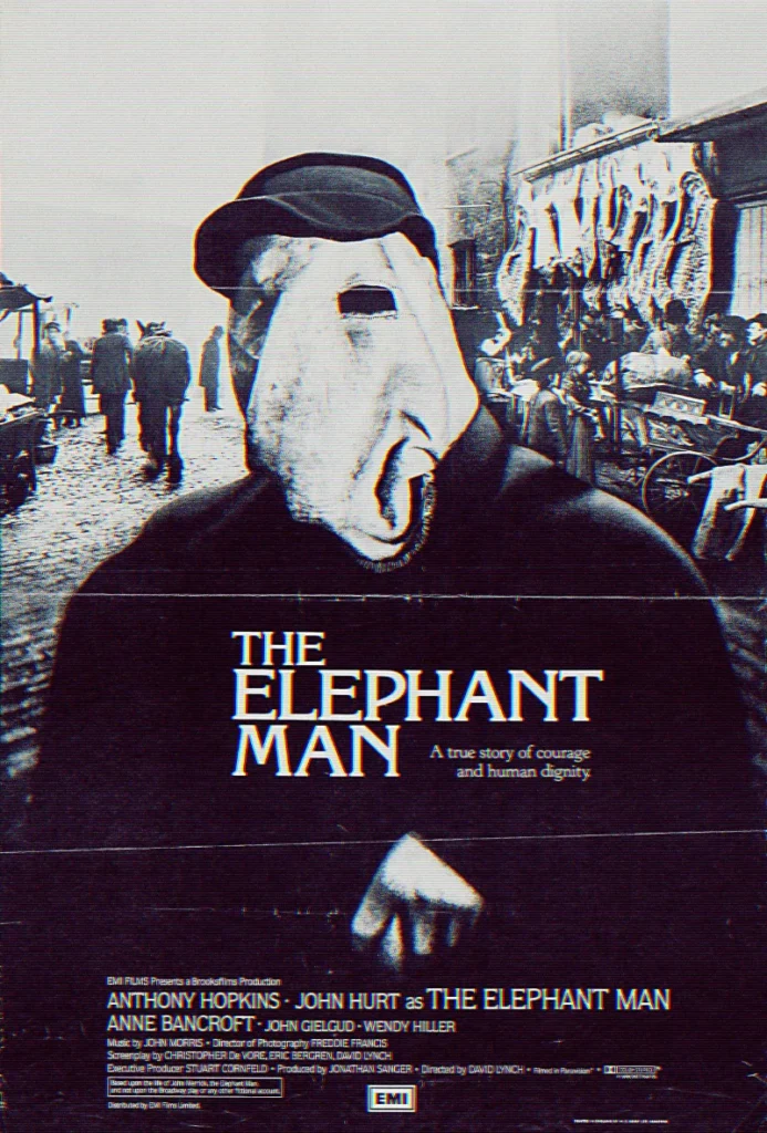 O Homem Elefante